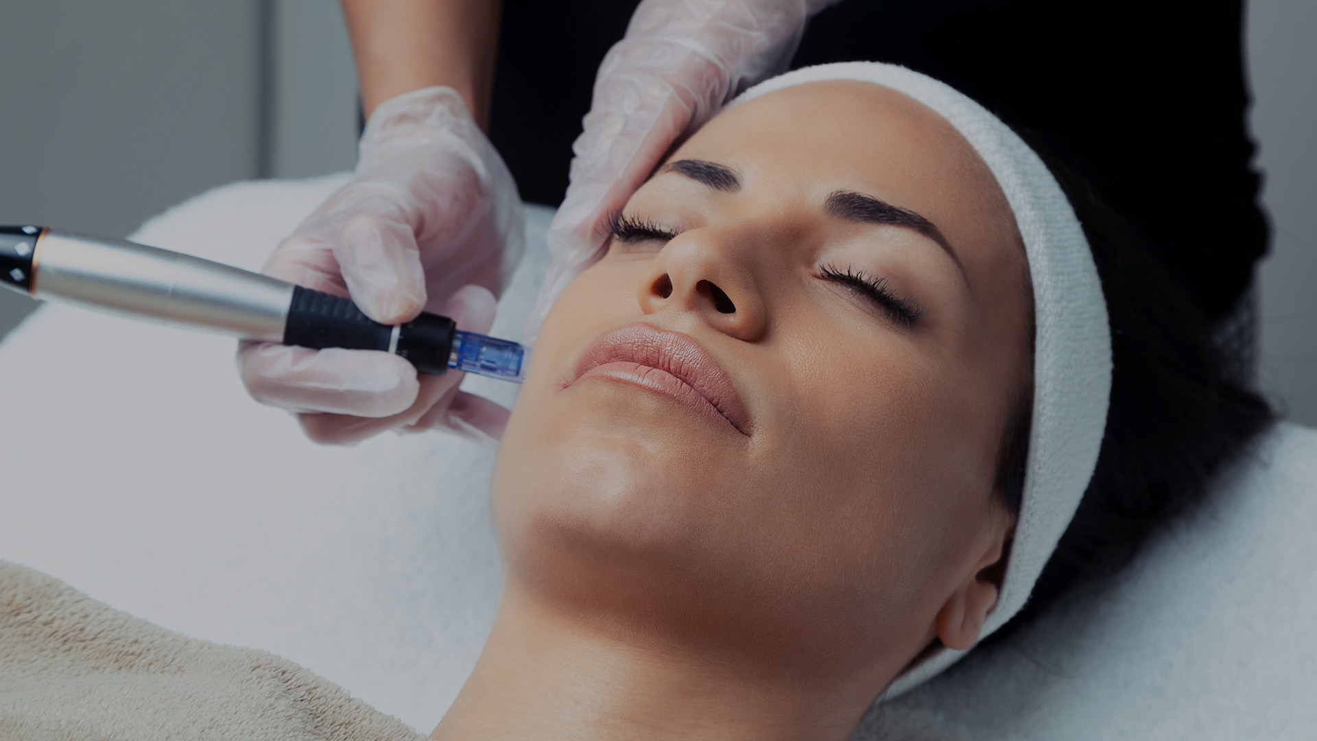 Microneedling