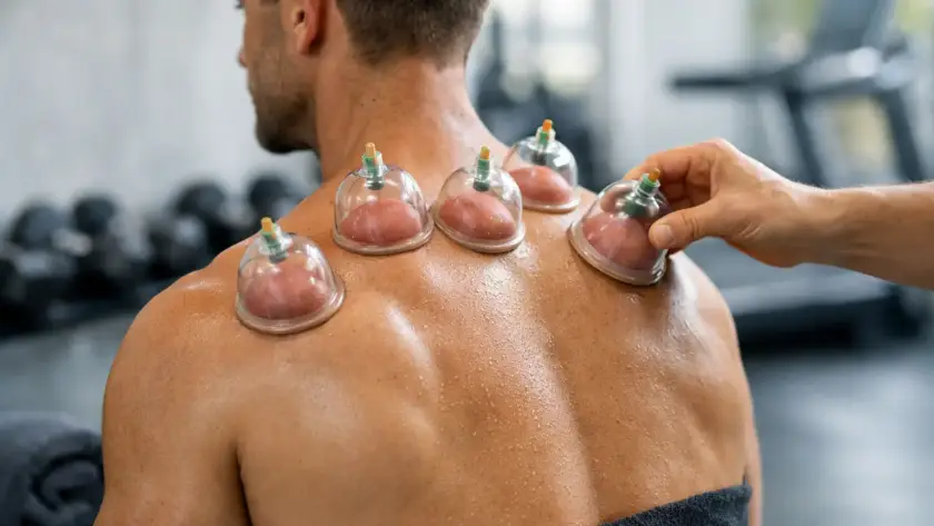 How Cupping Helps Muscle Recovery After Training